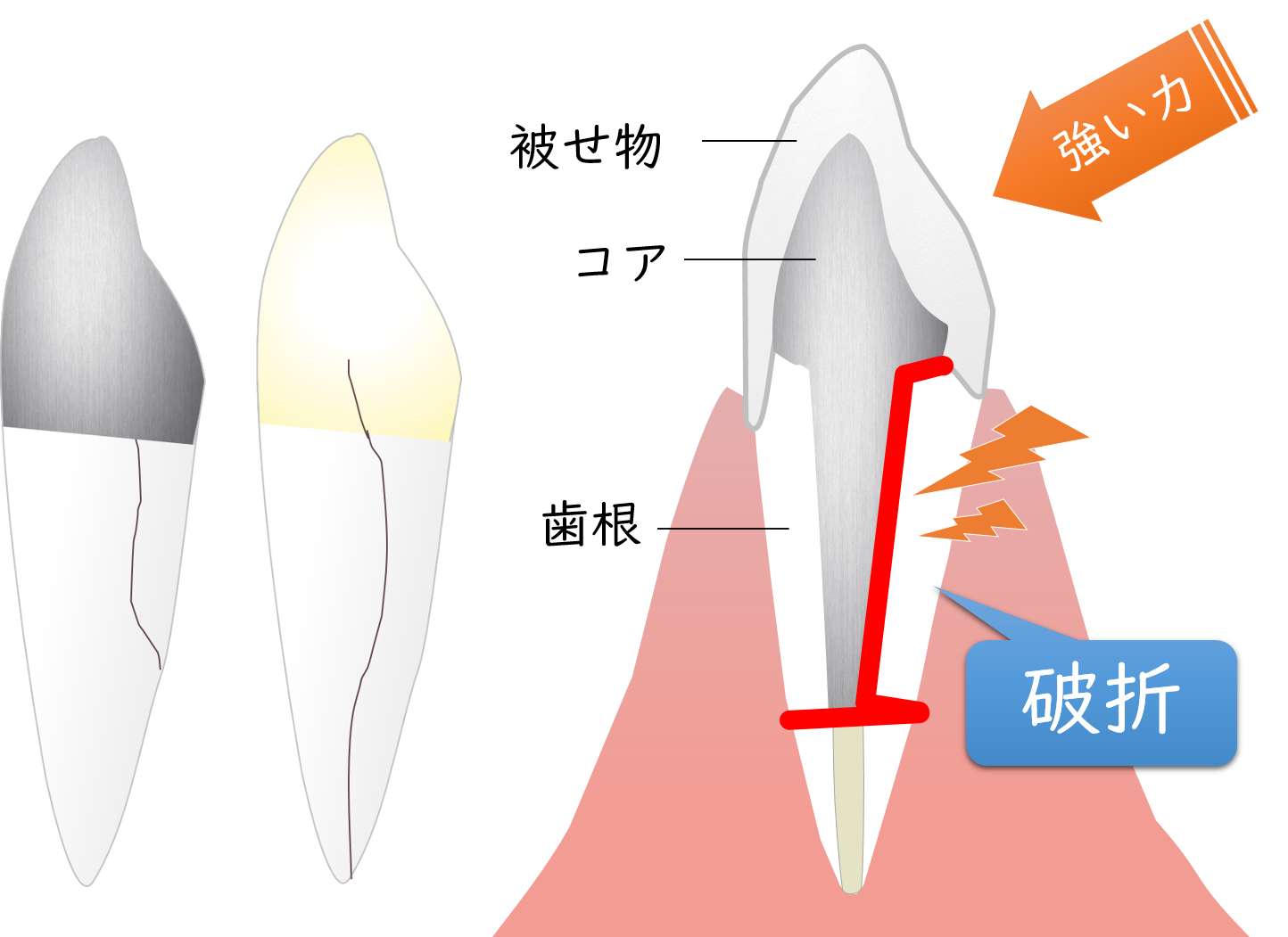 小田原市（鴨宮）の歯医者、鴨宮北口歯科の歯科用ＣＴ